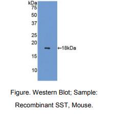 小鼠生长抑素(SST)多克隆抗体