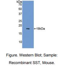 https://msimg.bioon.com/bionline/goods-no-pic.png