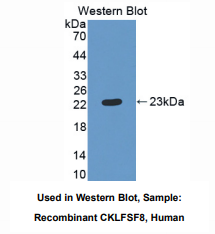 人趋化素样因子超家族成员8(CKLFSF8)多克隆抗体