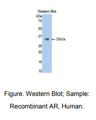 人雄激素受体(AR)多克隆抗体
