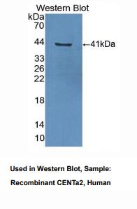 人矢车菊苷α2(CENTa2)多克隆抗体