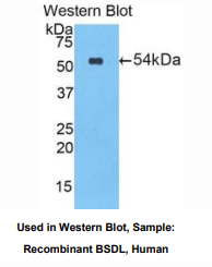 https://msimg.bioon.com/bionline/goods-no-pic.png