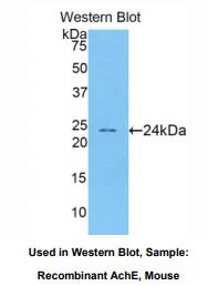 小鼠乙酰胆碱酯酶(ACHE)多克隆抗体