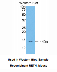 https://msimg.bioon.com/bionline/goods-no-pic.png