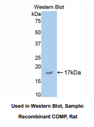 https://msimg.bioon.com/bionline/goods-no-pic.png