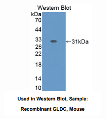 https://msimg.bioon.com/bionline/goods-no-pic.png