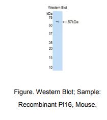 小鼠肽酶抑制因子16(PI16)多克隆抗体