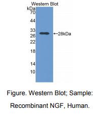 人神经生长因子(NGF)多克隆抗体