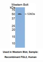 人纤维介素蛋白(FGL2)多克隆抗体