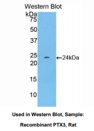 大鼠正五聚蛋白3(PTX3)多克隆抗体