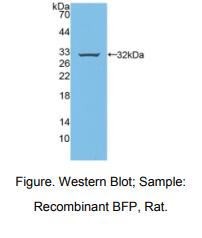 https://msimg.bioon.com/bionline/goods-no-pic.png