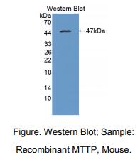 小鼠微粒体甘油三酸酯转运蛋白(MTTP)多克隆抗体