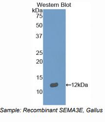 鸡信号素3E(SEMA3E)多克隆抗体