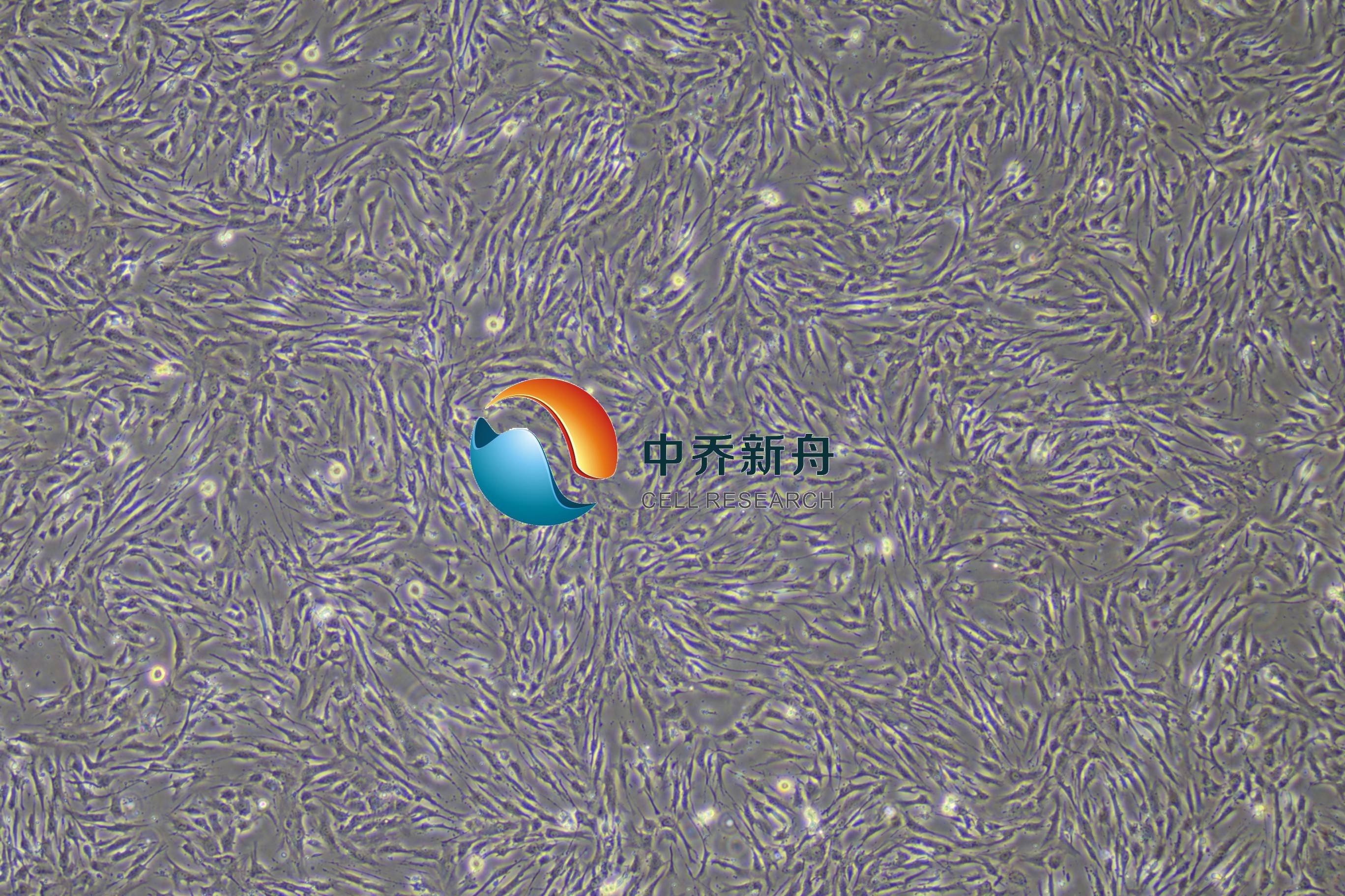 人雪旺细胞永生化