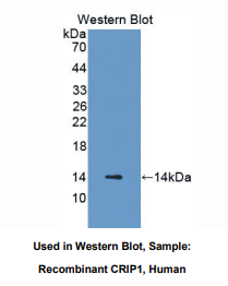 https://msimg.bioon.com/bionline/goods-no-pic.png