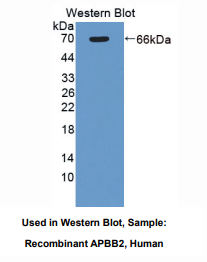 https://msimg.bioon.com/bionline/goods-no-pic.png