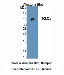 https://msimg.bioon.com/bionline/goods-no-pic.png