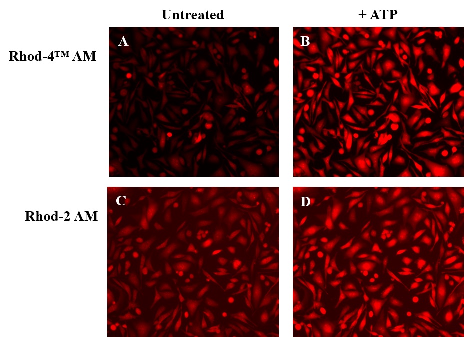 https://img.medsci.cn/e73eefcea40976357f460123cbf1e819c54e5106c9b457225be13b1cbc991aff.png