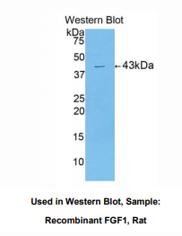 https://msimg.bioon.com/bionline/goods-no-pic.png