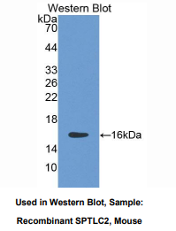 https://msimg.bioon.com/bionline/goods-no-pic.png