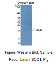 猪超氧化物歧化酶1(SOD1)多克隆抗体