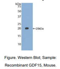 https://msimg.bioon.com/bionline/goods-no-pic.png