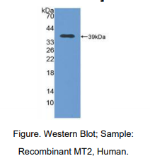 https://msimg.bioon.com/bionline/goods-no-pic.png