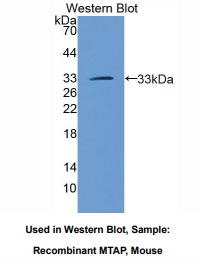 https://msimg.bioon.com/bionline/goods-no-pic.png