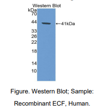 https://msimg.bioon.com/bionline/goods-no-pic.png