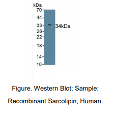 https://msimg.bioon.com/bionline/goods-no-pic.png