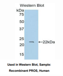 https://msimg.bioon.com/bionline/goods-no-pic.png