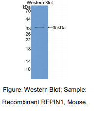 https://msimg.bioon.com/bionline/goods-no-pic.png