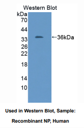 https://msimg.bioon.com/bionline/goods-no-pic.png