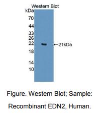 https://msimg.bioon.com/bionline/goods-no-pic.png