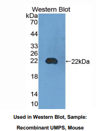 小鼠尿苷单磷酸合成酶(UMPS)多克隆抗体