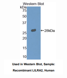 人白细胞免疫球蛋白样受体亚家族A成员2(LILRA2)多克隆抗体