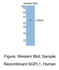 https://msimg.bioon.com/bionline/goods-no-pic.png