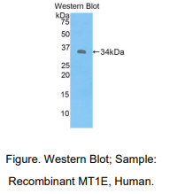 https://msimg.bioon.com/bionline/goods-no-pic.png