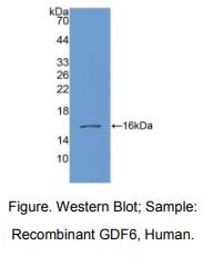 https://msimg.bioon.com/bionline/goods-no-pic.png