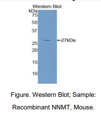 小鼠尼克酰胺-N-甲基转移酶(NNMT)多克隆抗体
