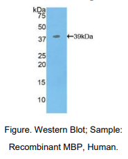 人髓鞘碱性蛋白(MBP)多克隆抗体