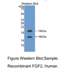 https://msimg.bioon.com/bionline/goods-no-pic.png