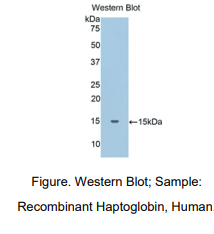 https://msimg.bioon.com/bionline/goods-no-pic.png