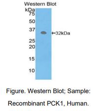 https://msimg.bioon.com/bionline/goods-no-pic.png