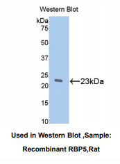 大鼠视黄醇结合蛋白5(RBP5)多克隆抗体