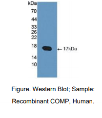 人软骨寡聚基质蛋白(COMP)多克隆抗体