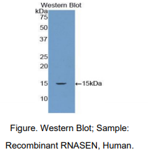 人核糖核酸酶Ⅲ(RNASEN)多克隆抗体