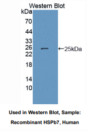 https://msimg.bioon.com/bionline/goods-no-pic.png