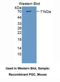 https://msimg.bioon.com/bionline/goods-no-pic.png