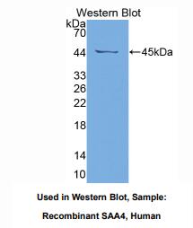 人血清淀粉样蛋白A4(SAA4)多克隆抗体
